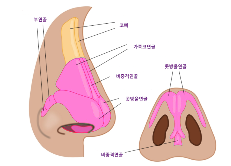 남자코수술, 휜코 때문에 비대칭된 인상 교정하기 사진 6