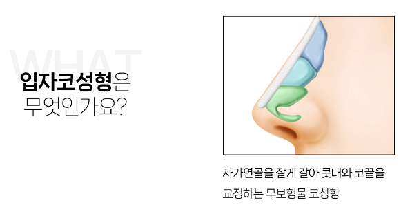 낮은코성형, 자연스러운 입체감 살리는 코성형 포인트 사진 6
