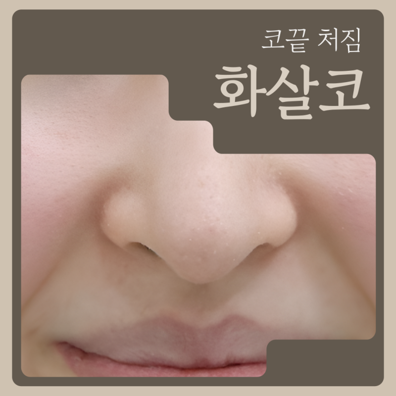 코끝 처짐, 화살코 코끝만 교정한다고 끝이 아닙니다