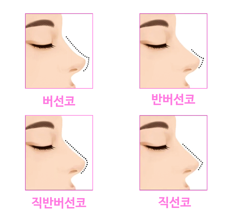 직반라인, 자연스러움은 ‘디자인’에서 결정됩니다 사진 3