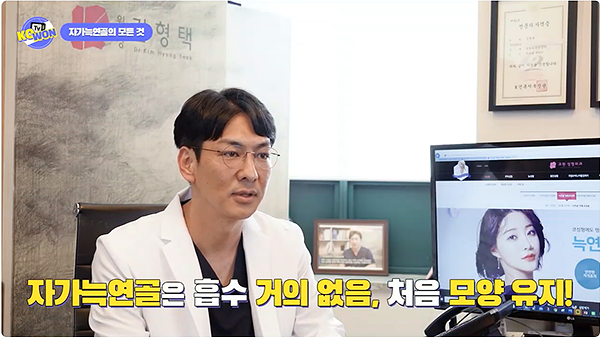 짧은코성형, 자가늑연골 기준 사진 5