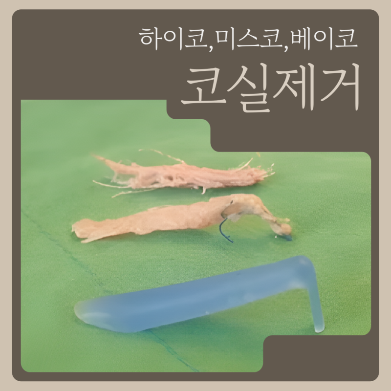 코실제거, 하이코제거, 단순 제거로는 충분하지 않을 수 있습니다