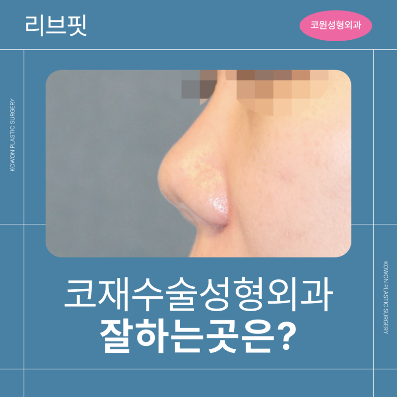 코재수술성형외과 잘하는 곳, 리브핏 가능한지 확인하세요!