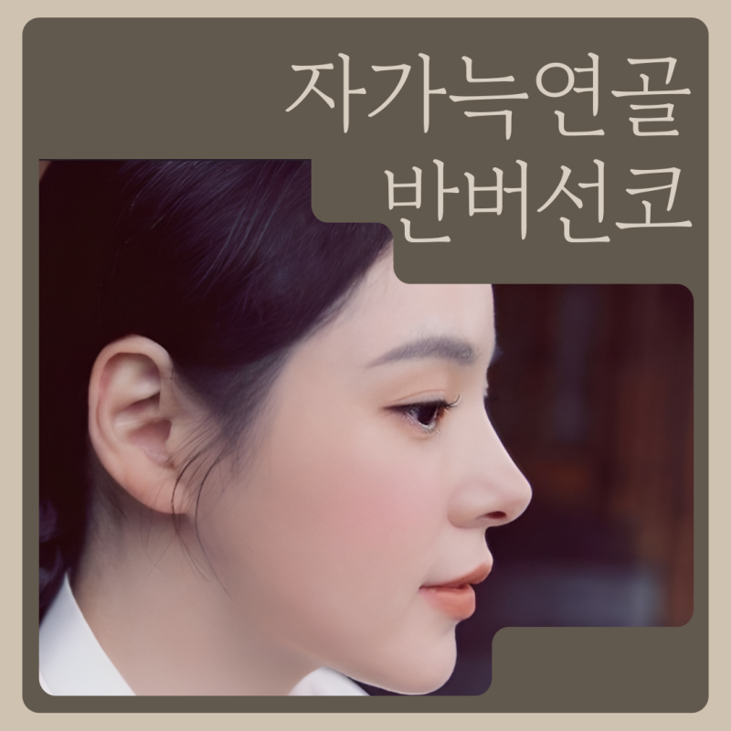 반버선코, 자가늑연골 선택은 얼굴 구조에서 갈립니다