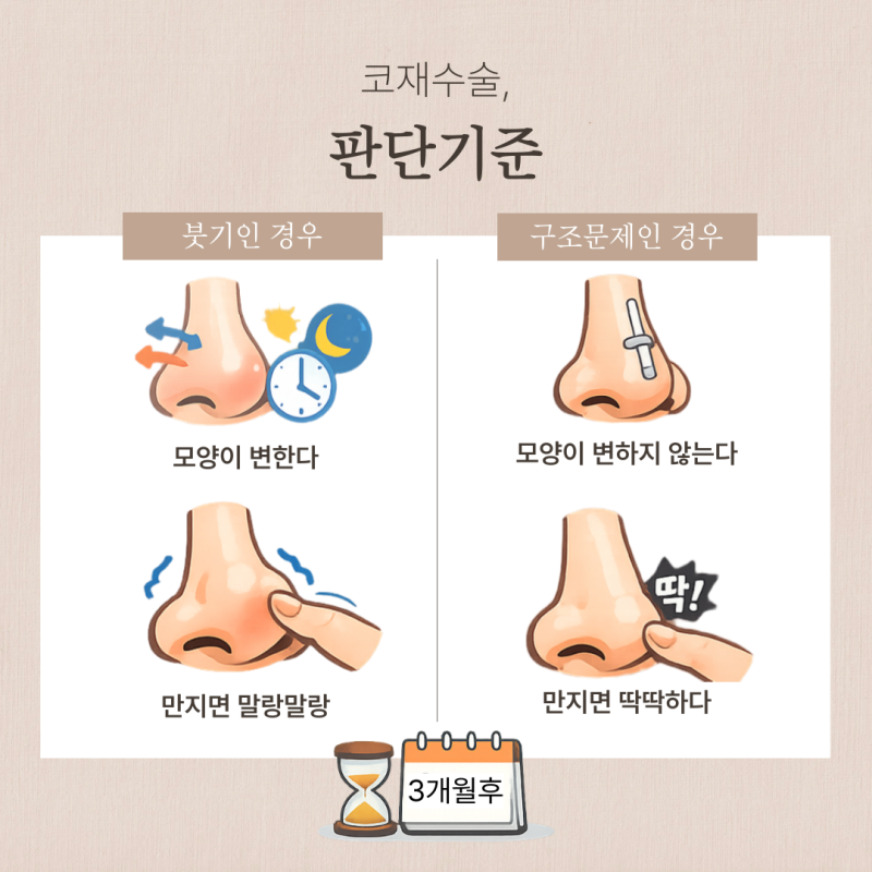 코재수술잘하는곳, 자가늑연골 선택 전 상담 기준 사진 5