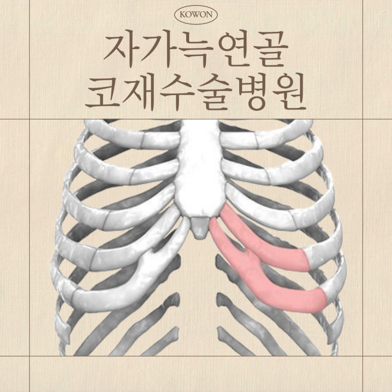자가늑연골로 보는 코재수술병원 판단 포인트