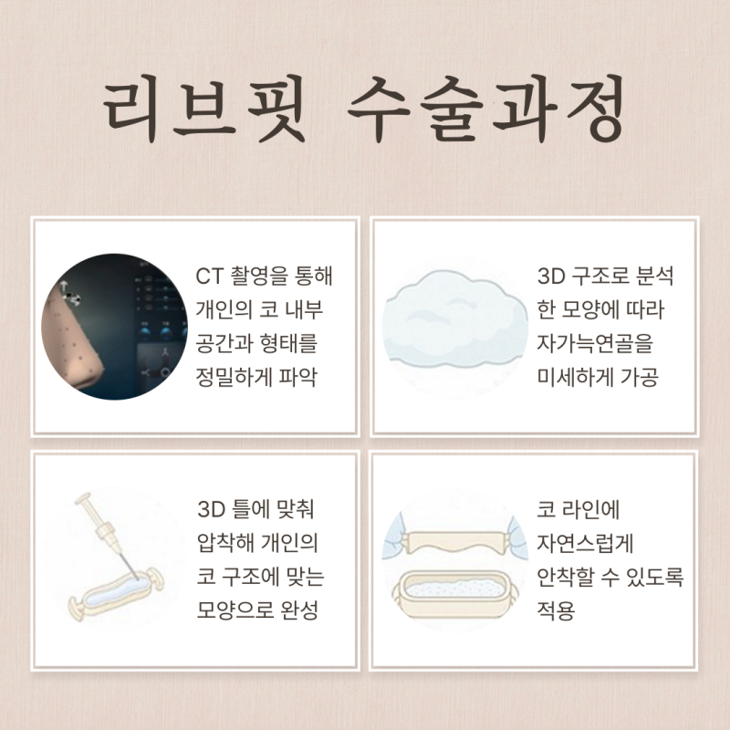 찝힌코, 코재수술이 필요한 상태일까요? 사진 7