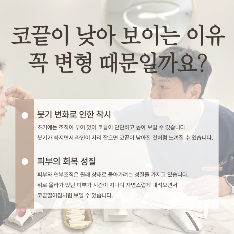 코끝떨어짐, 코끝성형 후 처지는 느낌은 정상일까요? 사진 4