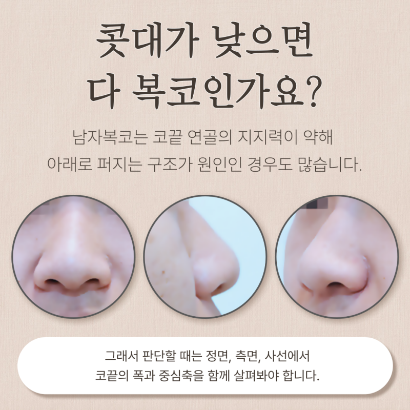 남자복코, 신사역 코성형외과 선택 기준은 무엇일까요? 사진 3