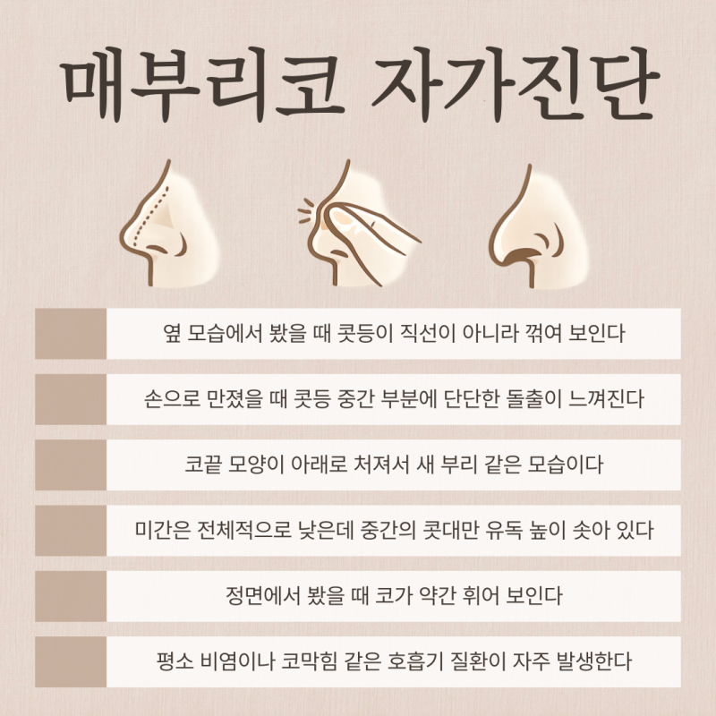 여자매부리코, 무보형물코수술로도 교정이 가능할까요? 사진 4