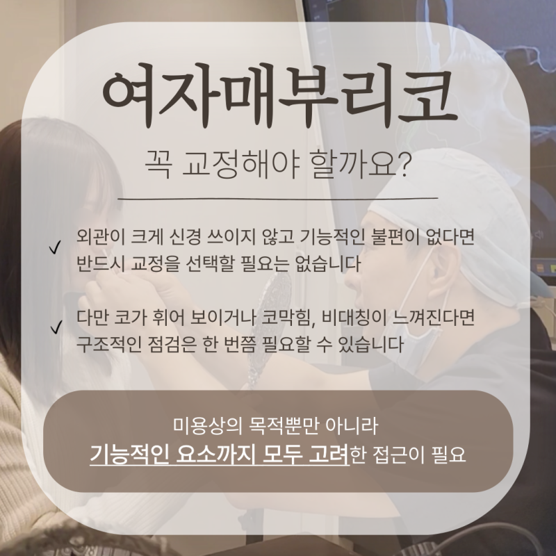 여자매부리코, 무보형물코수술로도 교정이 가능할까요? 사진 5