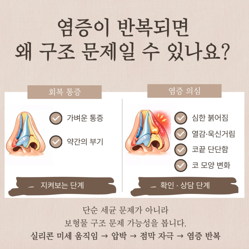 코끝통증, 염증일까요? 코재수술까지 가는 경우는 언제인가요? 사진 4