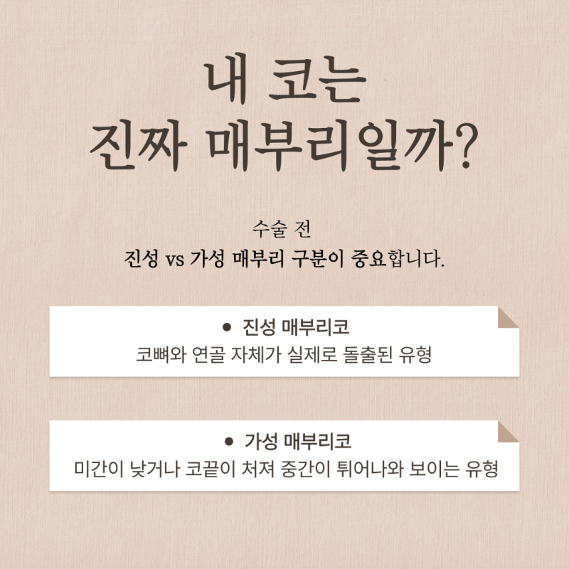 코절골술, 매부리코 정말 뼈를 깎는 과정이 필수일까요? 사진 4