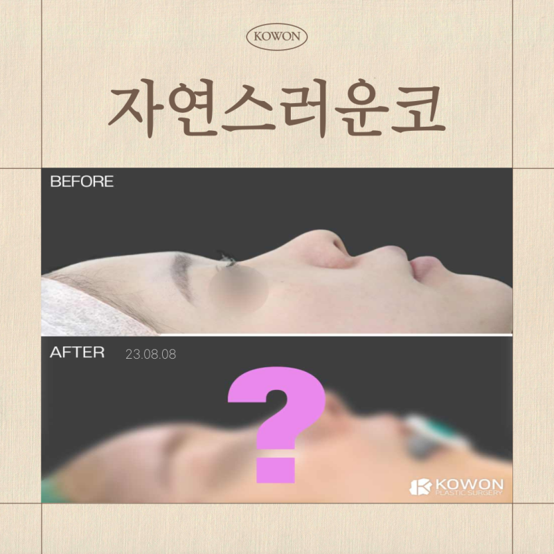 자연스러운코 완성하는 자가늑입자, 실패 없는 선택 기준은 무엇인가요?