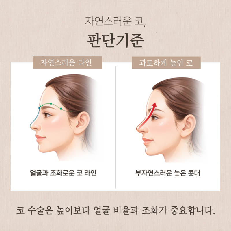 자연스러운코 완성하는 자가늑입자, 실패 없는 선택 기준은 무엇인가요? 사진 3