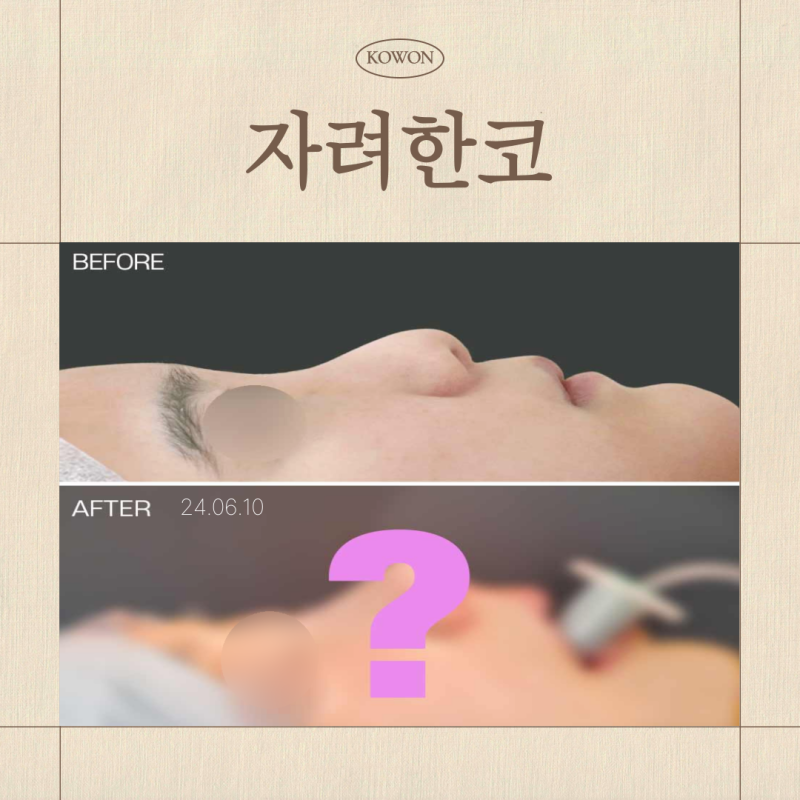 자려한코, 낮은코도 가능할까? 자연스러움과 입체감을 만드는 기준