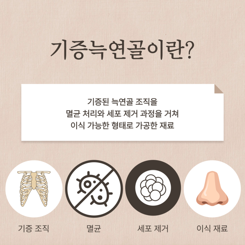 기증늑연골 장점 단점 무엇일까? 코성형 연골 선택 기준 정리 사진 3