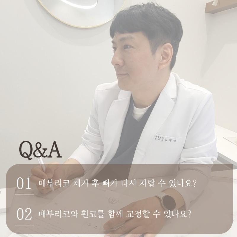 매부리코성형, 무보형물 교정 가능한 코는 따로 있습니다｜유형별 수술 방법 정리 사진 3