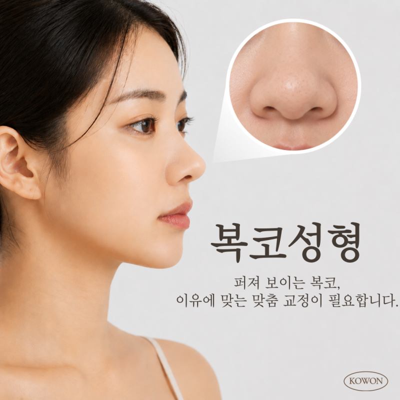 복코성형, 뭉툭한코·주먹코·웃을 때 퍼진코… 콧볼만 줄이면 될까요?